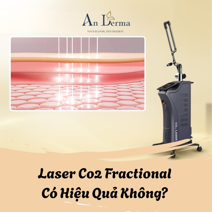 Laser Co2 Fractional Có Hiệu Quả Không? Bí Quyết Làm Đẹp An Toàn và Hiệu Quả