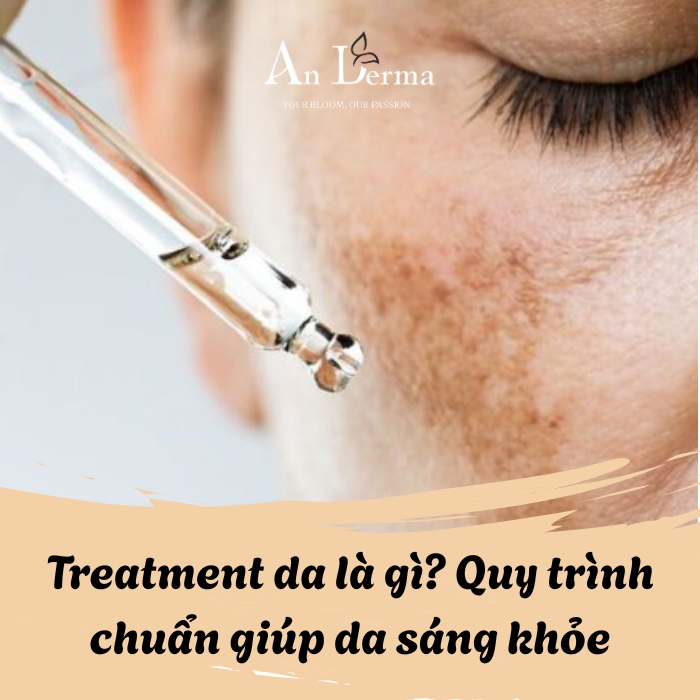 Treatment da là gì? Quy trình chuẩn giúp da phục hồi và sáng khỏe